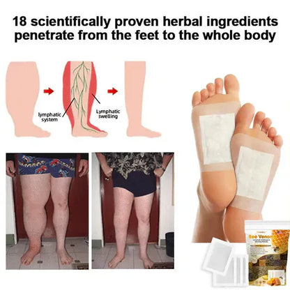Premium Bee Venom Foot Patches (Pack of 10) BUY 1 GET 1 FREE