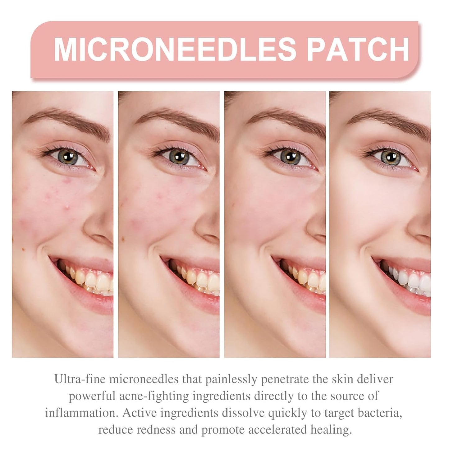 Derma Smooth Skin Tag Removal Patch | Secret To Spotless Skin